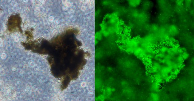 Ecometalsbacteria.jpg