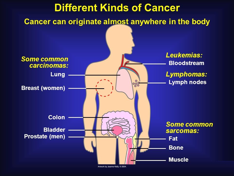 signs-and-symptoms-of-cancer.jpg