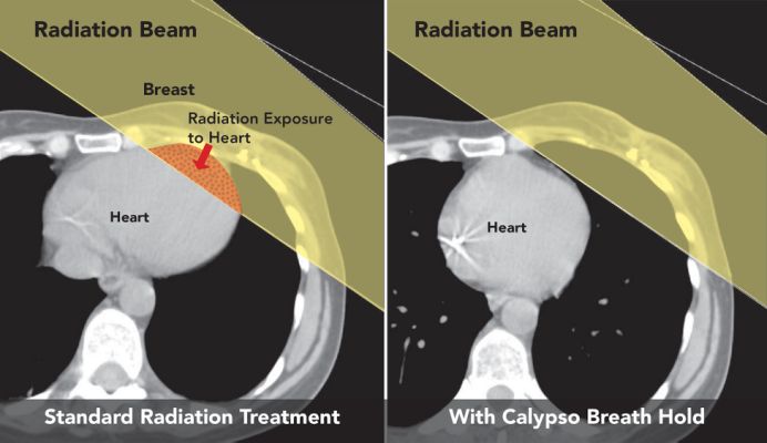 Calypso-BreathHold-web.jpg.cf.jpg