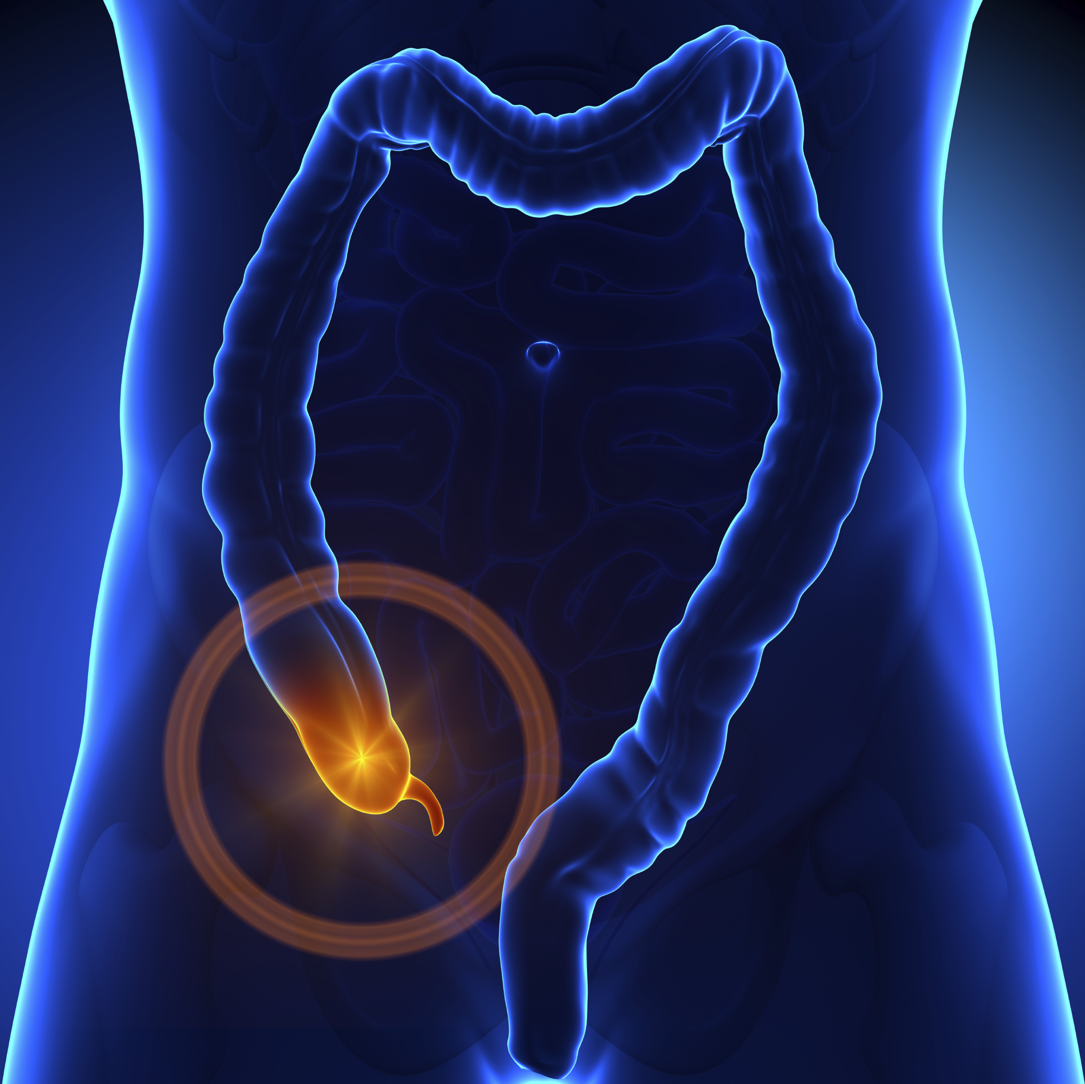 appendix-appendicitis.jpg