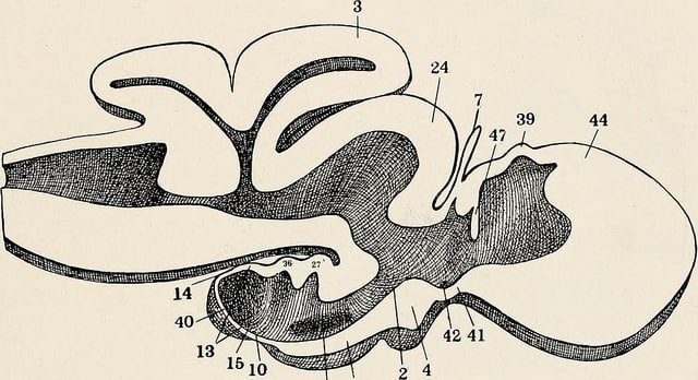 pineal-1.jpg