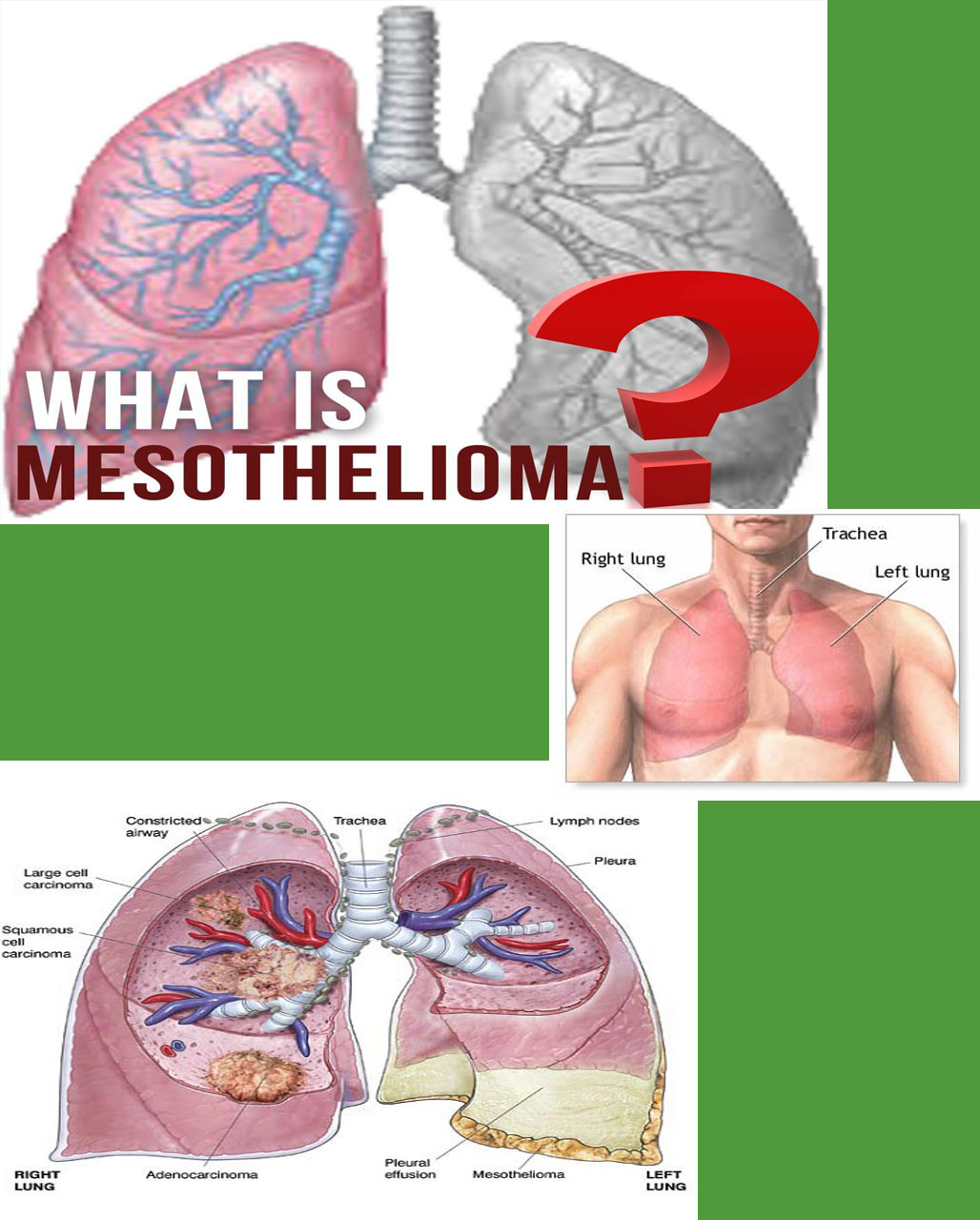 mesot.jpg