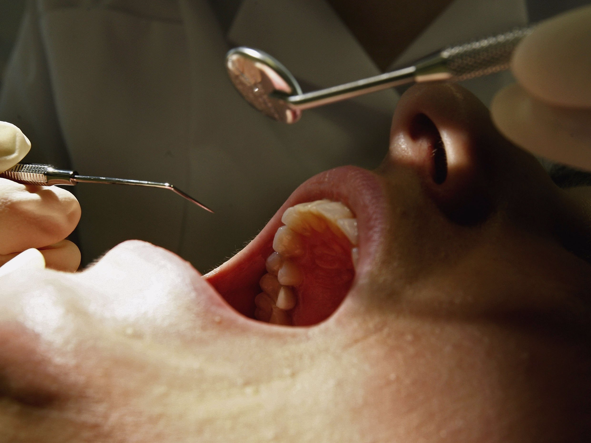 dental-fillings-for-your-cavities-could-soon-be-a-thing-of-the-past.jpg