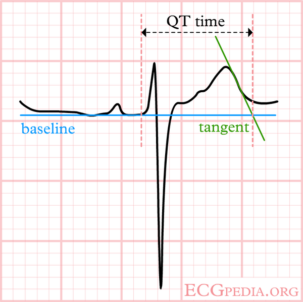 De-LastigeQT2_(CardioNetworks_ECGpedia).png