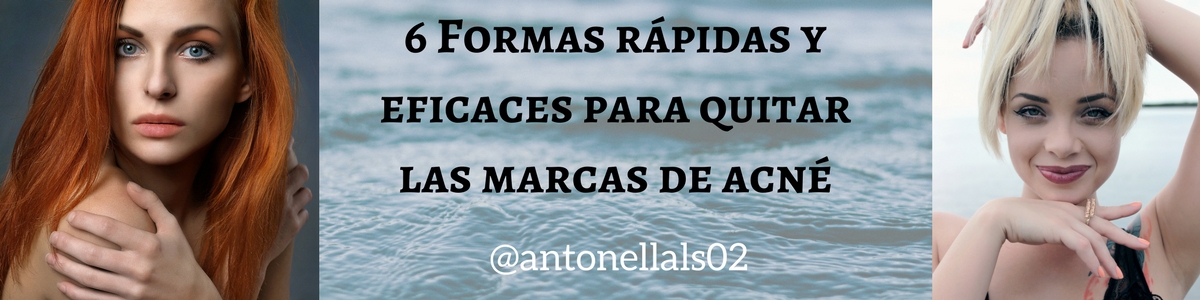 6 Formas rápidas y eficaces para quitar las marcas de acné.jpg