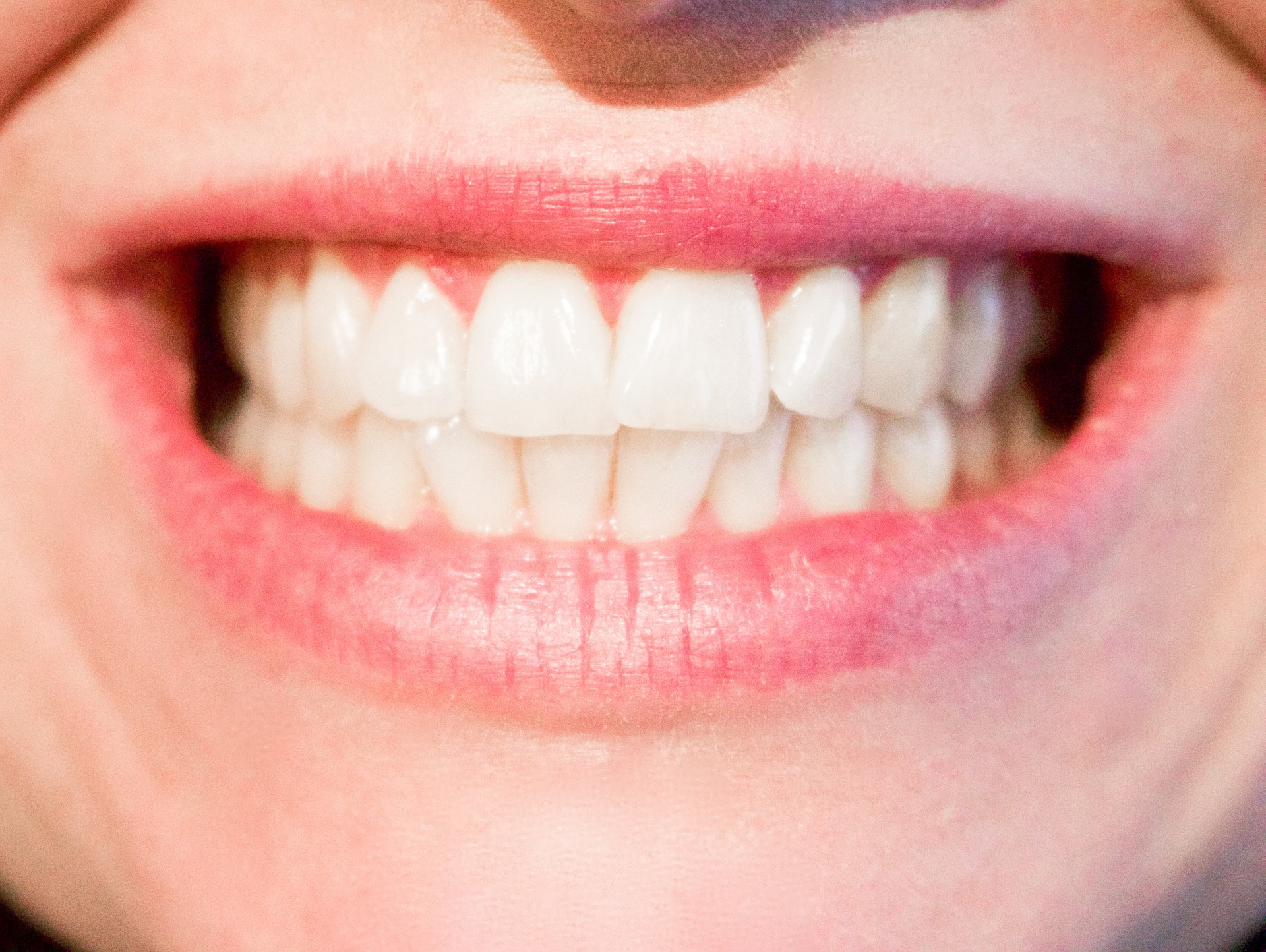 teeth-1652976_1920.jpg