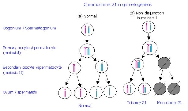 chromosome-21-disjunction.jpg