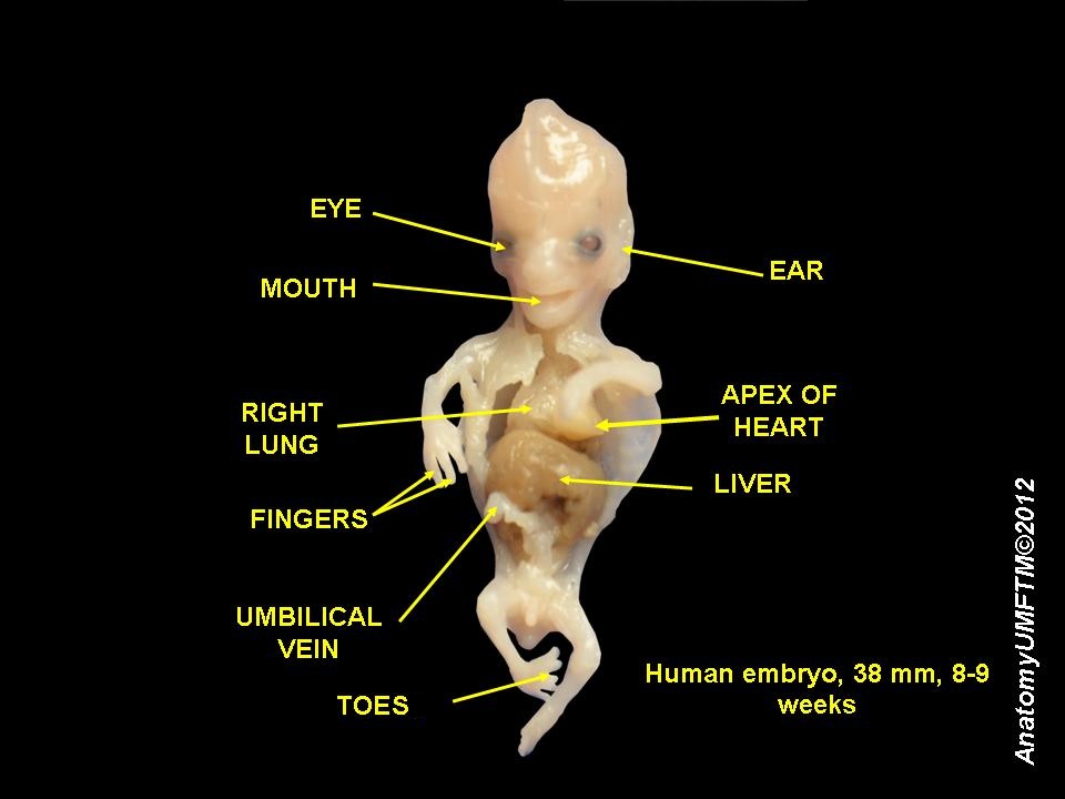 Human_embryo_8_weeks.JPG
