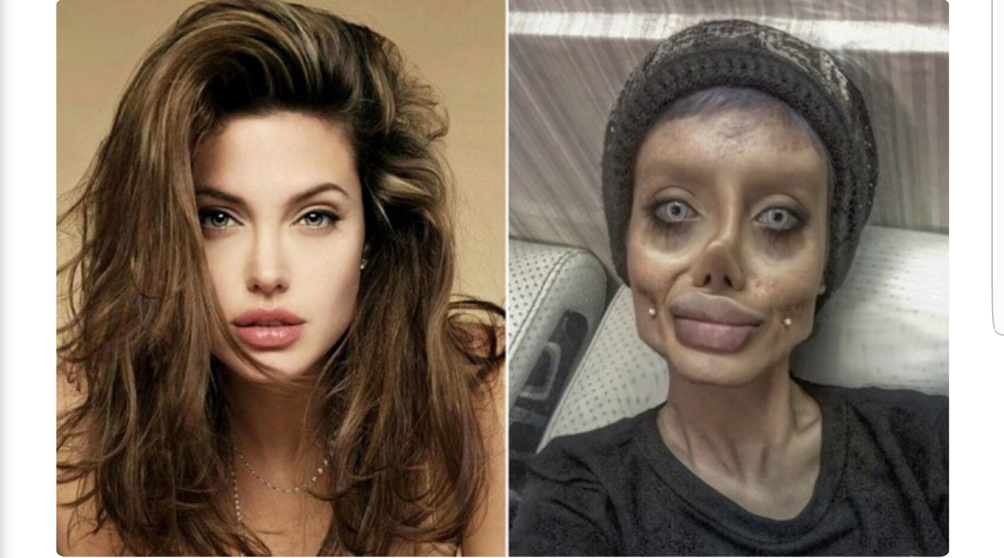 Angelina jolie lookalike plastic surgery