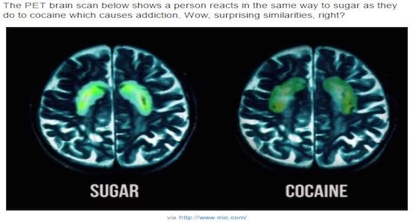 brain on sugar.jpg