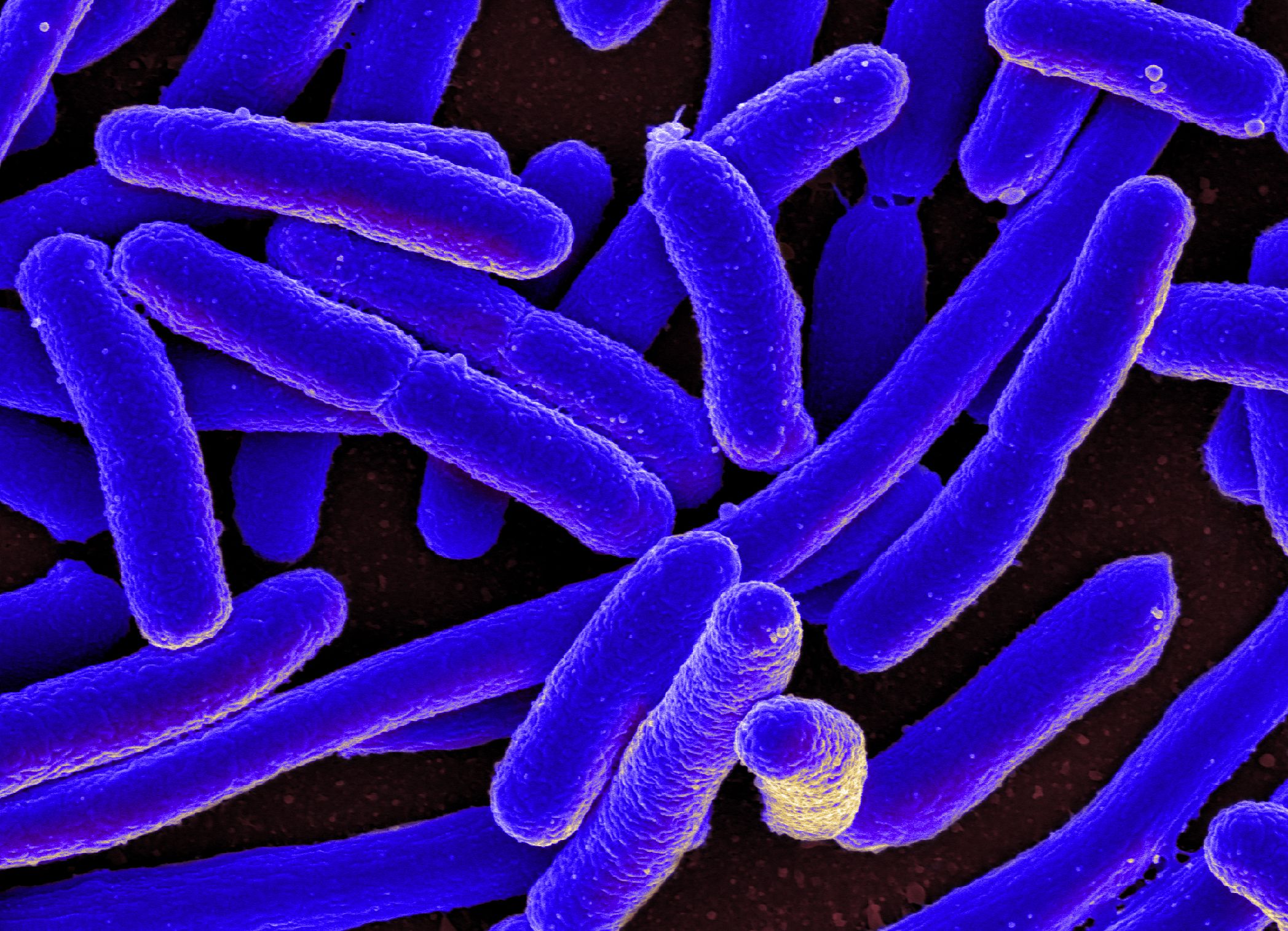 E._coli_Bacteria_(16578744517).jpg