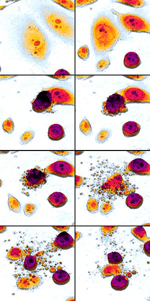 Apoptosis_DU145_cells_mosaic.jpg