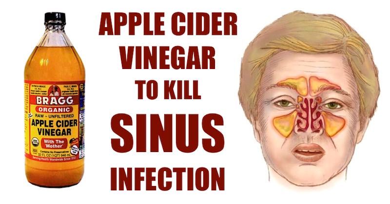 acv-sinus-infection.jpg