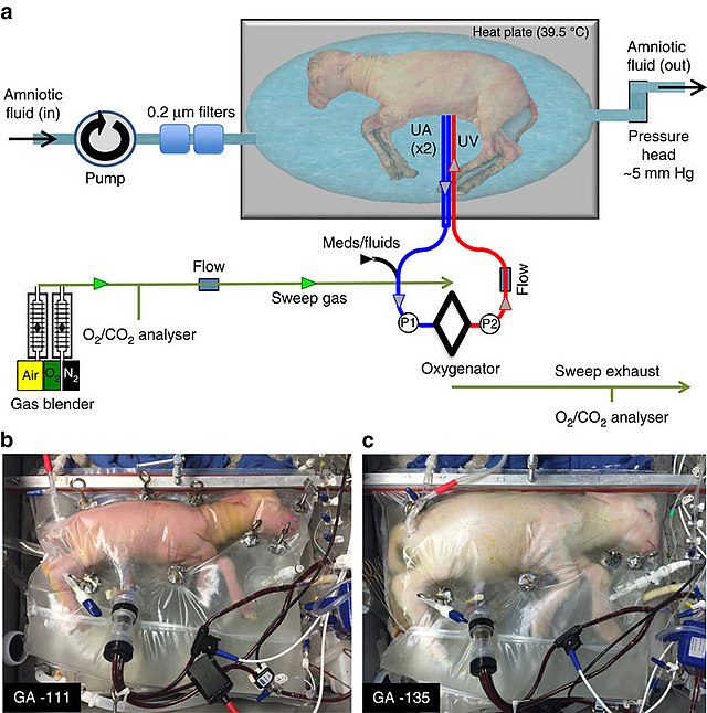 640px-Nature_Communications_Biobag_system_design (1).jpg