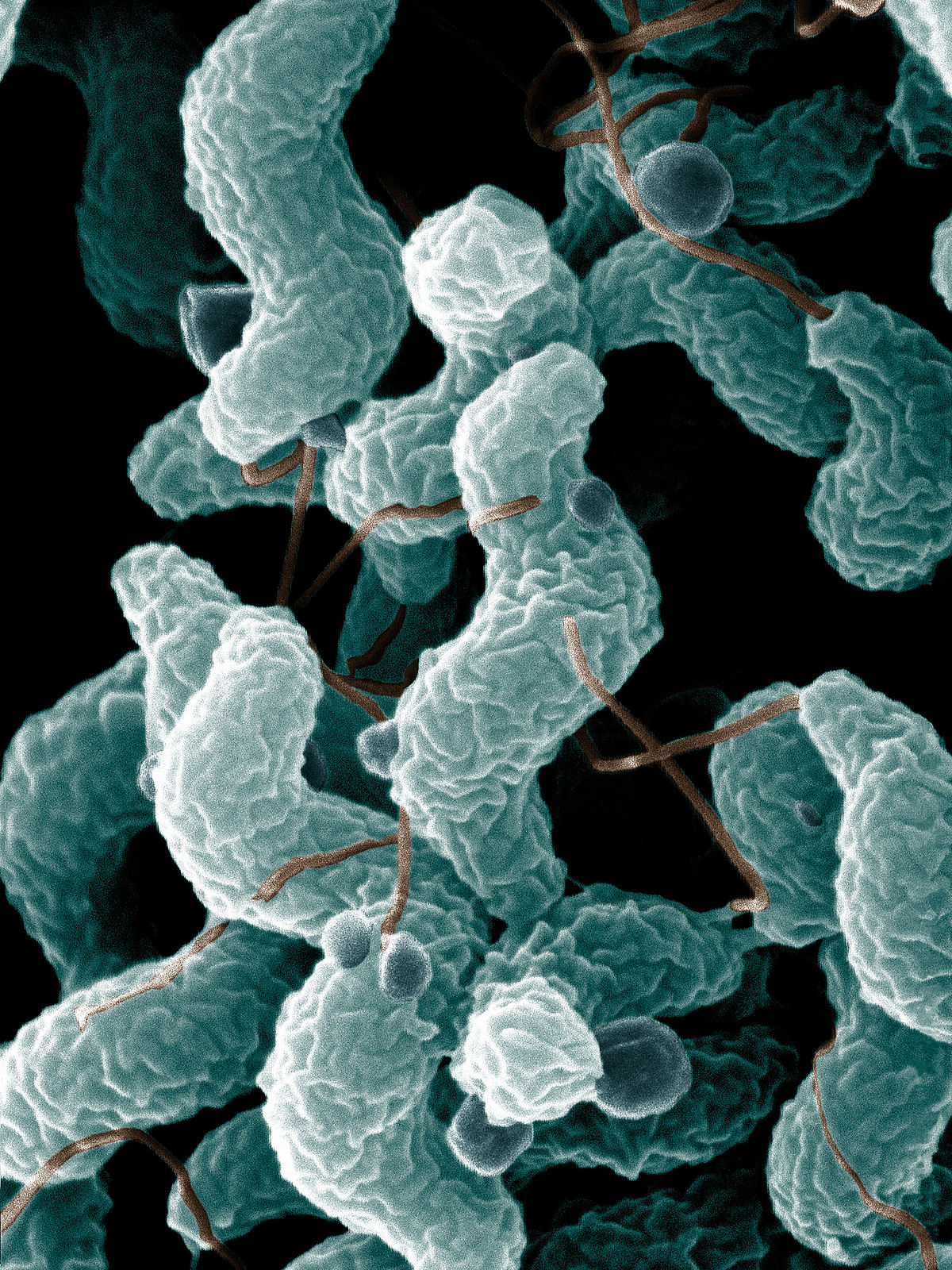 ARS_Campylobacter_jejuni.jpg