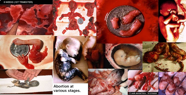 abortions.jpg
