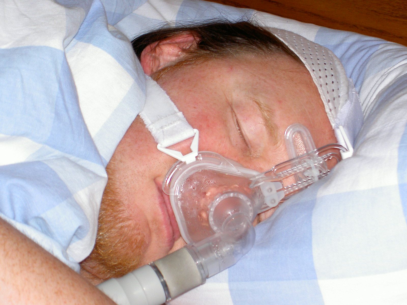 Sleep Apnea Devices.jpg