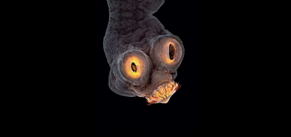 infección intestinal parasitaria