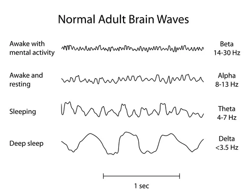 Brain-Waves.png