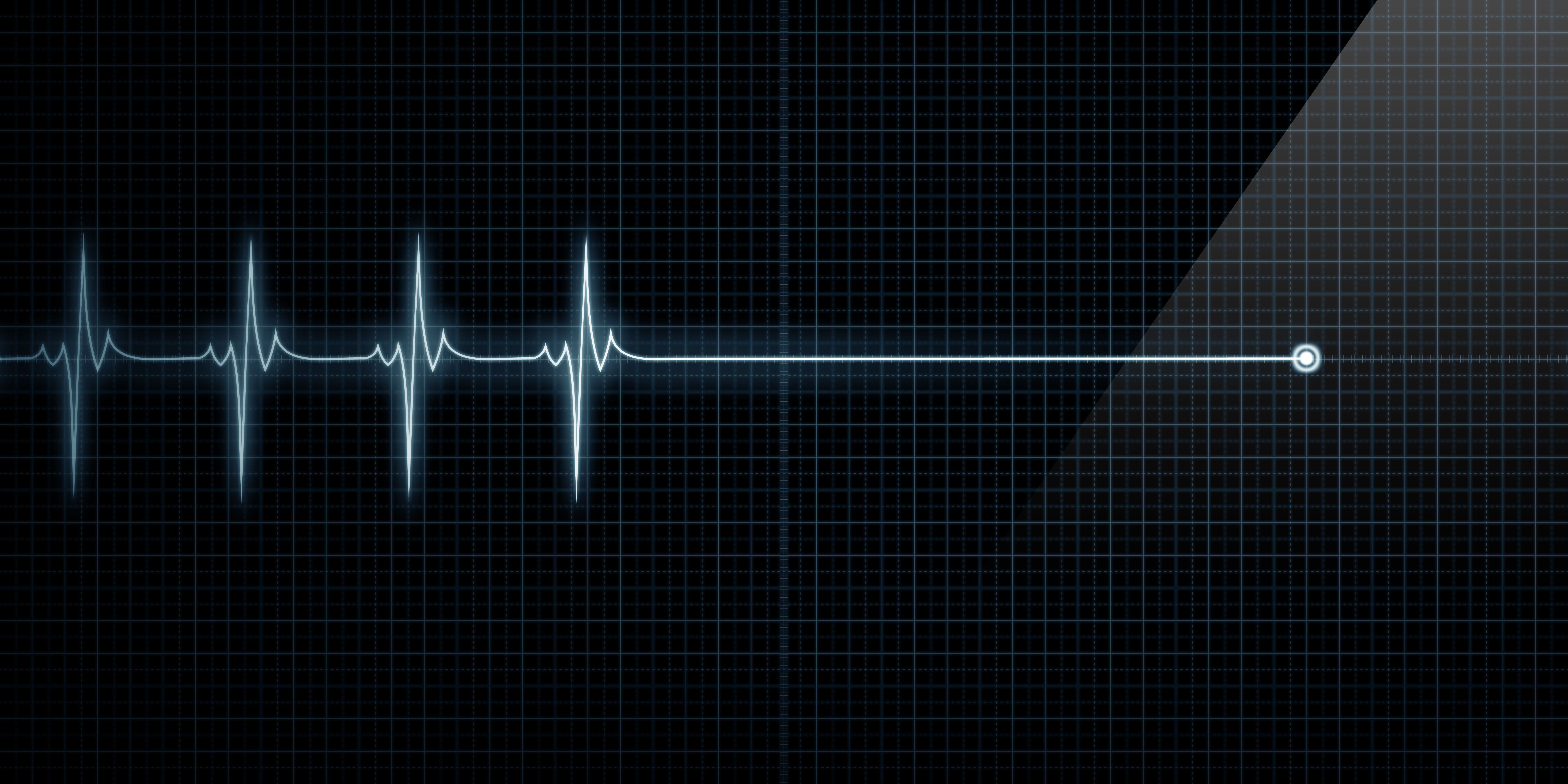 После прямой линии. Прямая кардиограмма. Кардиограмма остановки сердца. Пульс. Линия кардиограммы.