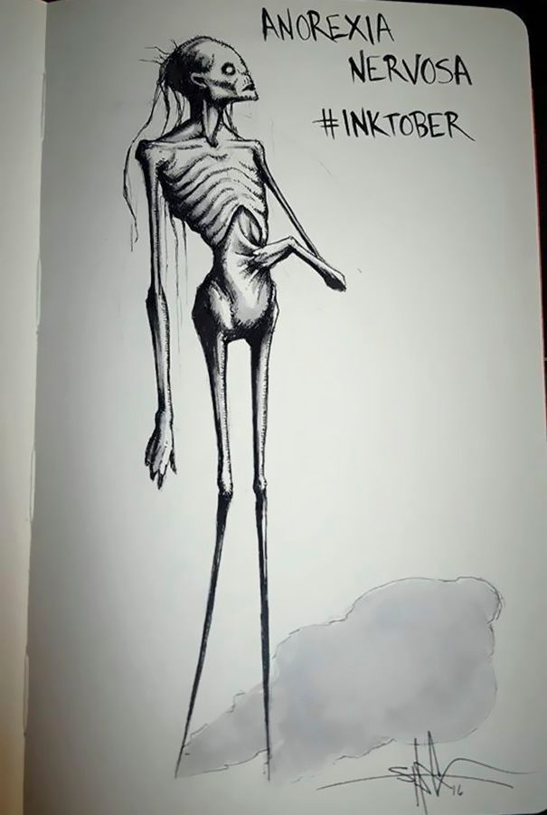 Anorexia Nervosa.jpg