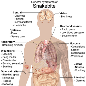 Snake-bite-symptoms.png