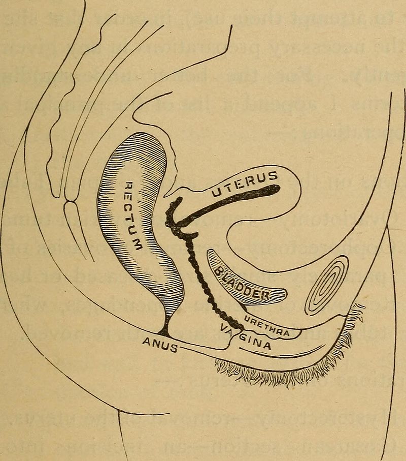 Nursing_in_abdominal_surgery_and_diseases_of_women_(1893)_(14788477803).jpg