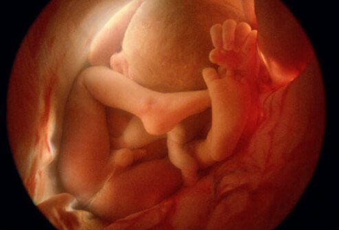 fetal_36_week_fetus_s12a.jpg