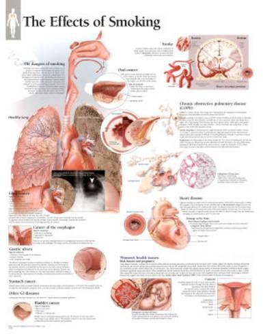 laminated-effects-of-smoking-educational-chart-poster_a-G-8927446-0.jpg
