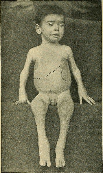 The_diseases_of_children_-_medical_and_surgical_(1900)_(14781042361).jpg