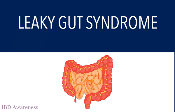 Leaky Gut Syndrome: Measurement, Test and Treatment — Steemit