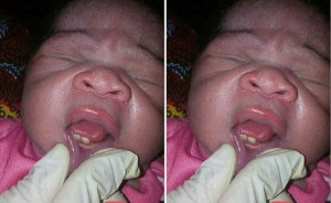Baby Born With Teeth Spiritual Meaning  