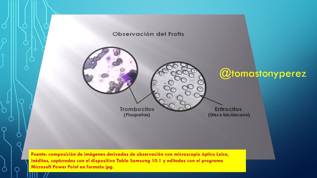 Observacion_Trombo_Eritrocitos.JPG