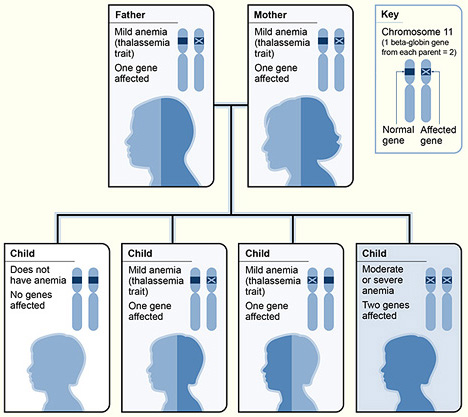 Thalassemia_beta.jpg