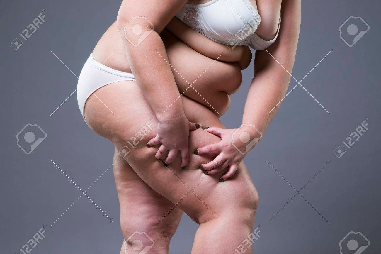 82750365-overweight-woman-with-fat-legs-obesity-female-body-on-gray-background.jpg