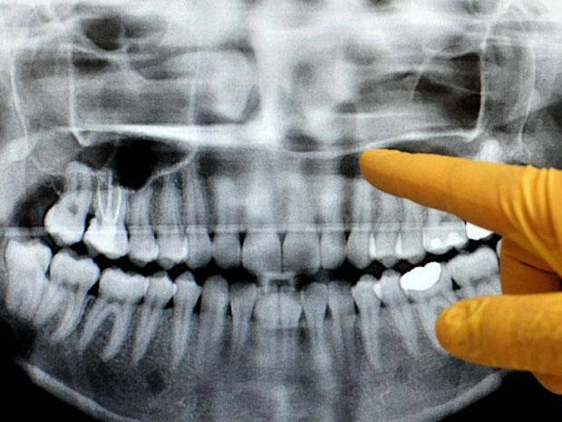 Dental Radiography.jpg