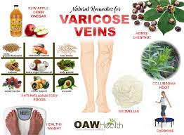 homeopathic remedies varicosis 1.jpg