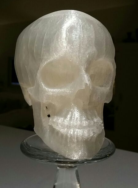 3D_Printed_Macrognathism.jpg