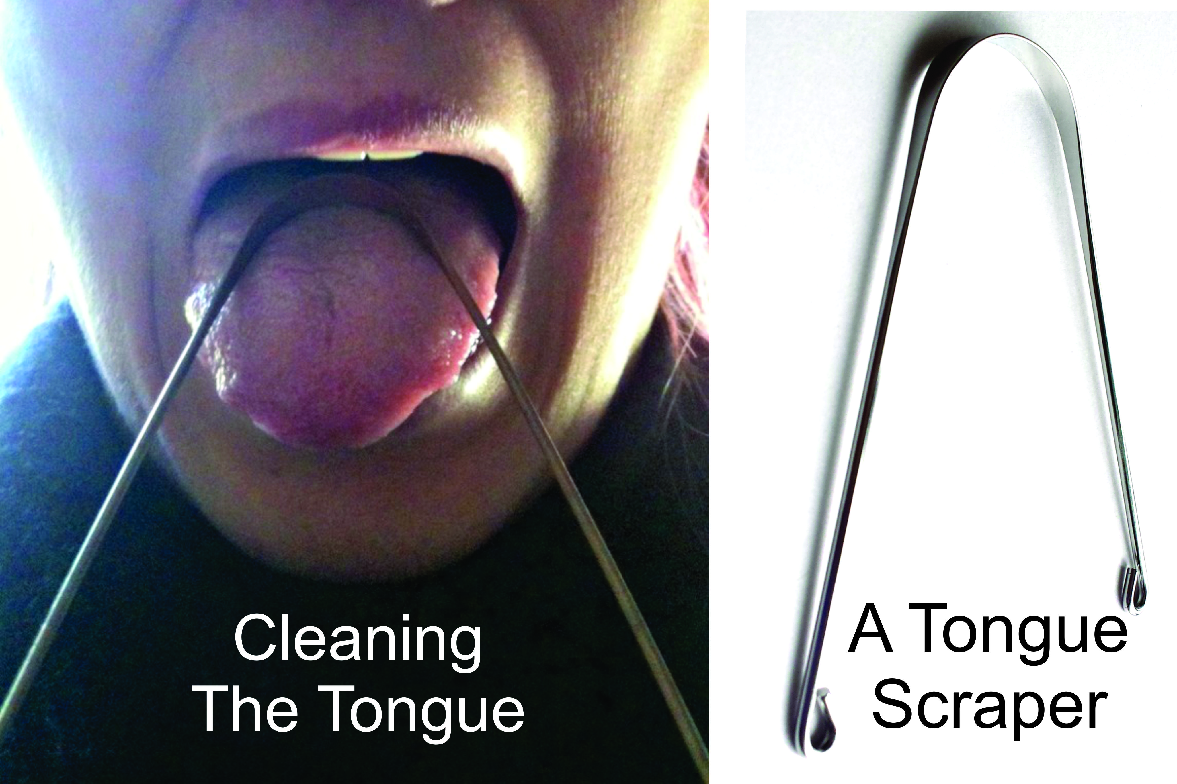 tongue scrapers.jpg