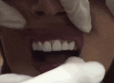 1.gif