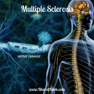 Multiple-Sclerosis.jpg