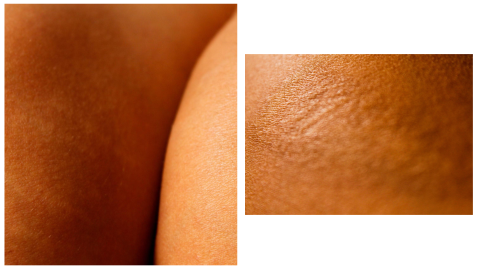 fotografia cuerpo (3).png