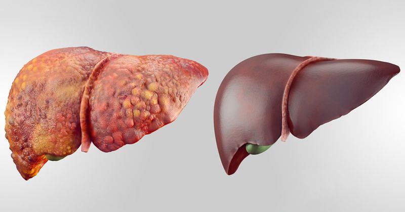 liver-detox-FI.jpg