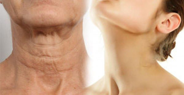Simple-Ways-On-How-To-Make-Your-Neck-Look-Younger-–-This-Is-Just-Amazing.jpg