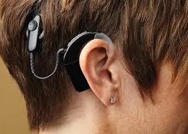 global cochlear implants market.jpg