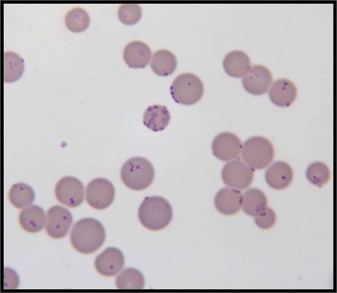 mycoplasma.jpg