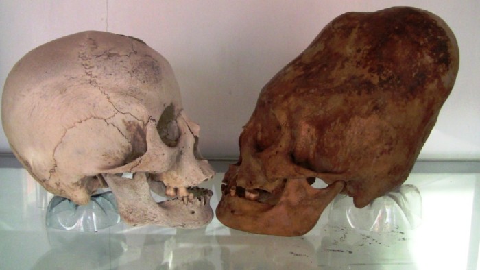 Elongated-skulls-Paracas-Peru.jpg