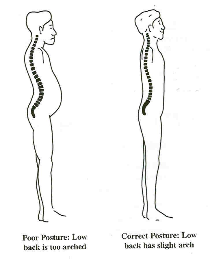 bad-posture1.jpg