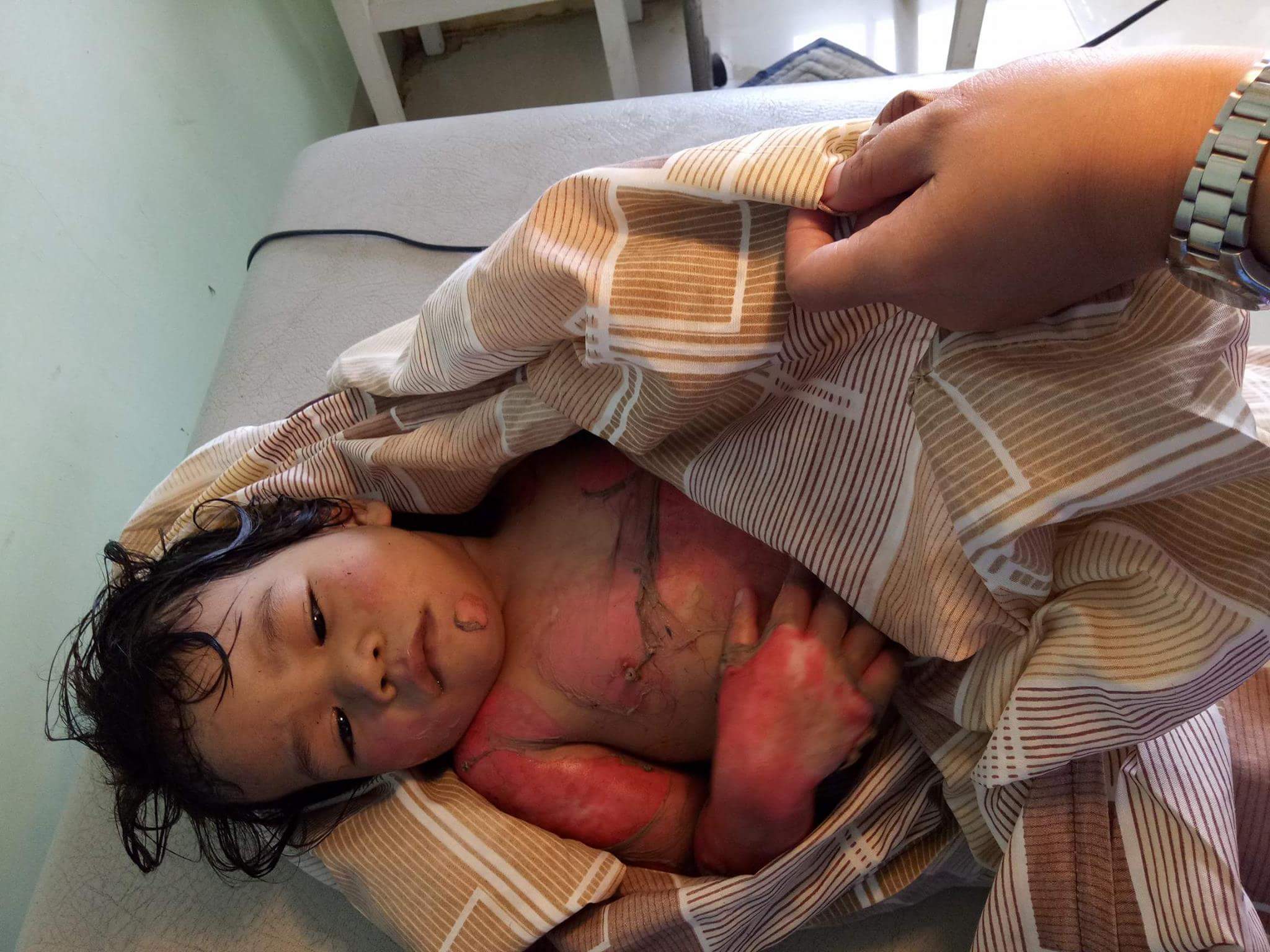 Its cool. I mean it was an accident. Kids set fire to homes all the time. Moms are GREAT!