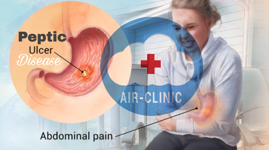 Air-Clinic Peptic Ulcer Disease.png